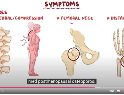 8 minuters video om orsaker, symtom, diagnos, behandling, patologi